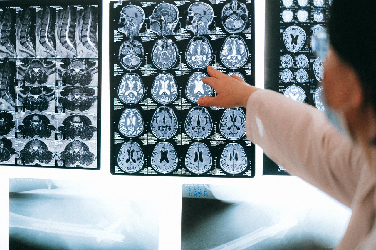 Image of brain scan - Jean-Francois de Clermont-Tonnerre